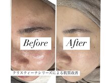 ル シェリア(Le Cherien)の雰囲気（毛穴・赤み・シミ・乾燥お肌のトラブルとさようなら）