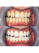 ライトビューティー 池袋店(LightBeauty)/症例写真