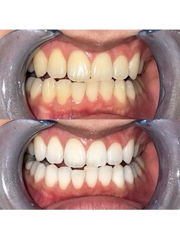 ライトビューティー 池袋店(LightBeauty)/症例写真