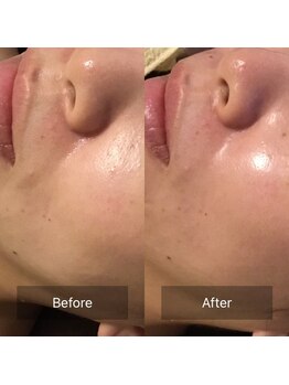 ファヴォリ(favori)/ゾンビマスク