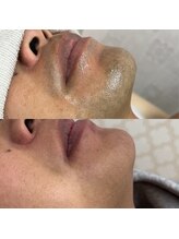 ジュエリー アンド ティアラ(Jewelry & Tiara)/