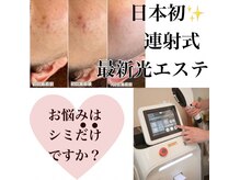 しみケア＆で明るい素肌に！