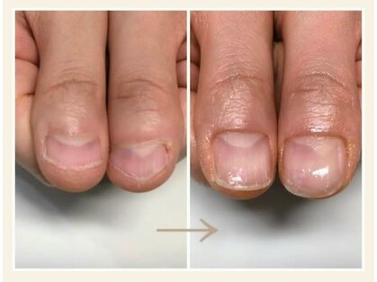 キュアネイル(Qa Nail)の写真