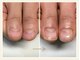 キュアネイル(Qa Nail)の写真