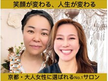 サロンチオリ 烏丸(Salon Chiori)の雰囲気（施術ごのスッキリ感で笑顔になれる、大人女性にNo. 1人気サロン）