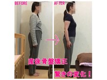 産後骨盤矯正は開業18年の豊富な実績と経験値から結果を出します