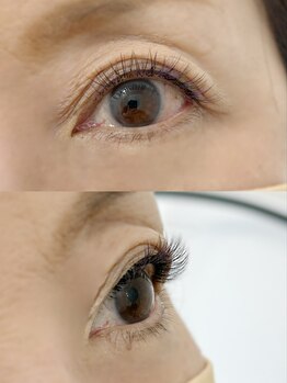 ムニ(muni)/LEDフラットラッシュ140本