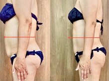 ソフィア(SOPHIA)