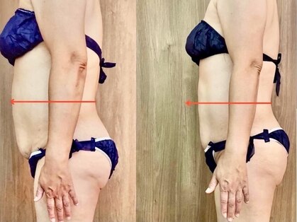 ソフィア(SOPHIA)の写真