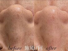 リスポアラボ(LIS PORE.LAB)/