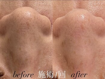 リスポアラボ(LIS PORE.LAB)/