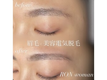 サロンロンウーマン(SALON RON woman)/眉毛脱毛