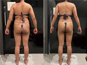 プリオール 高崎花水木店(Prior)/セルマジック痩身/全身痩身