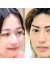 【眉×美肌】眉デザインWAX＋フェイシャルワックス全パーツ（RYU限定）
