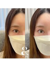 プレーン 恵比寿(Plain)/&Healthy