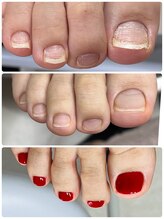 爪屋/本格的なFケアとカラー
