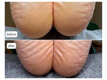 カシェット(Cachette)/50代女性◎足裏角質ケア90分