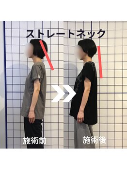 からだサロン サニー 堺東(SUNNY)/首こり・ストレートネック