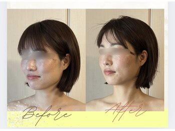 ママリラ(Mamarela)の写真/【土台から整う小顔】小顔矯正で蝶形骨のゆがみを整え、たるみ知らずのリフトアップ効果を実感!