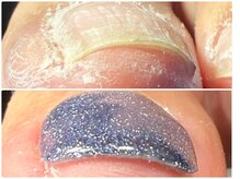 ミリアネイル 成城(Miliea nail)の雰囲気(当日から緩和!巻き爪解消しながらジェルカラーもできます♪)