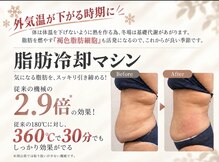アスプリール