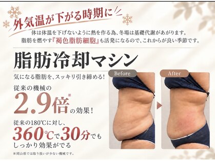 アスプリールの写真