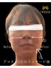 ビハーラ 門司店/お顔の緊張改善コース(顔筋)
