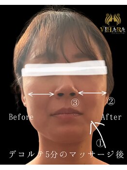 ビハーラ 門司店/お顔の緊張改善コース(顔筋)