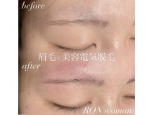 サロンロンウーマン(SALON RON woman)/眉毛脱毛