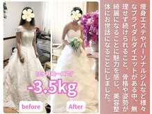 整体院成裕(整体院SEIYUU)/20代ブライダル実績(痩身/整体)
