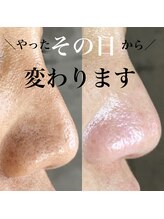 アーフ(ARF)/肌質改善