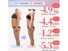 アフリオーラ はなみずき店(affriolant)/ビフォーアフター
