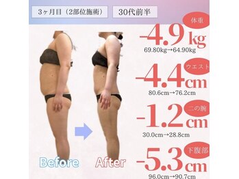 アフリオーラ はなみずき店(affriolant)/ビフォーアフター