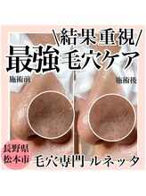 ルネッタ(Lunetta)/