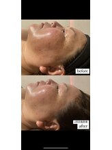 ディサイドロー(DECIDE L.A.W)/