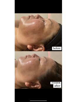 ディサイドロー(DECIDE L.A.W)/