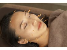 健康堂整骨院 大倉山新院/美容鍼 【大倉山/大倉山駅】