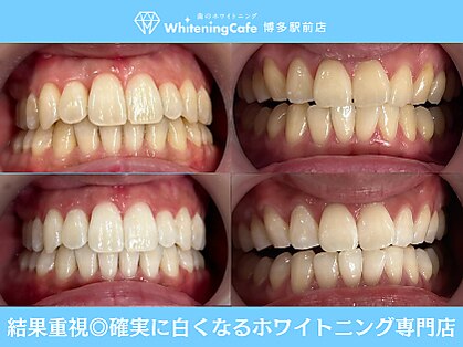 ホワイトニングカフェ 博多駅前店(WhiteningCafe)の写真