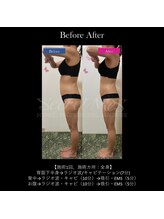 フェレザ 新潟(Felleza)/新潟-痩身エステ-BODYエステ