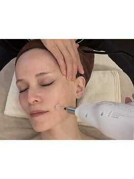 小顔になりたい