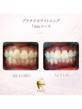 ドクターモック(Dr.MOC)/