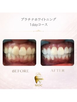 ドクターモック(Dr.MOC)/
