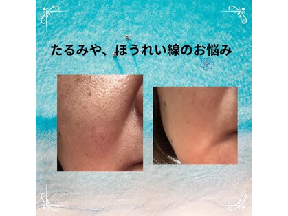 ルアナ(Luana)の写真