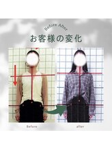 わく整体院/猫背・姿勢改善