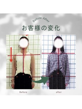 わく整体院/猫背・姿勢改善