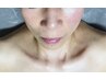 【お試し期間】シャープな輪郭◎リフトUPフェイシャル40分13800→4900円