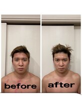 パラフューズ 札幌店 ブランジュ(PARAFUSE.)/PARAFUSE.ビフォーアフター