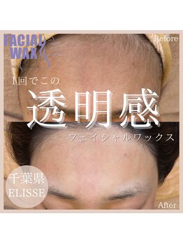 エリス(ELISSE)/フェイシャルワックスで透明感