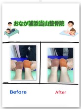 おなが浦添当山整骨院/骨盤の歪み改善！