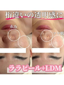 サロン(SALON)/ララピール+LDM